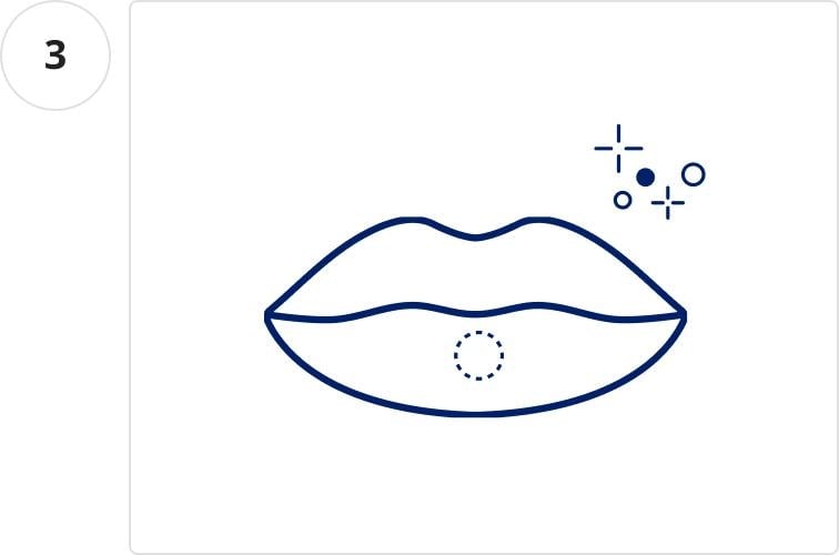 Step 3 - How to Use Perlz